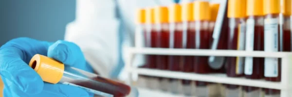 iStock_bloodtest_02